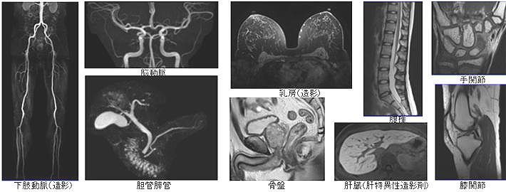 ＭＲＩ検査画像